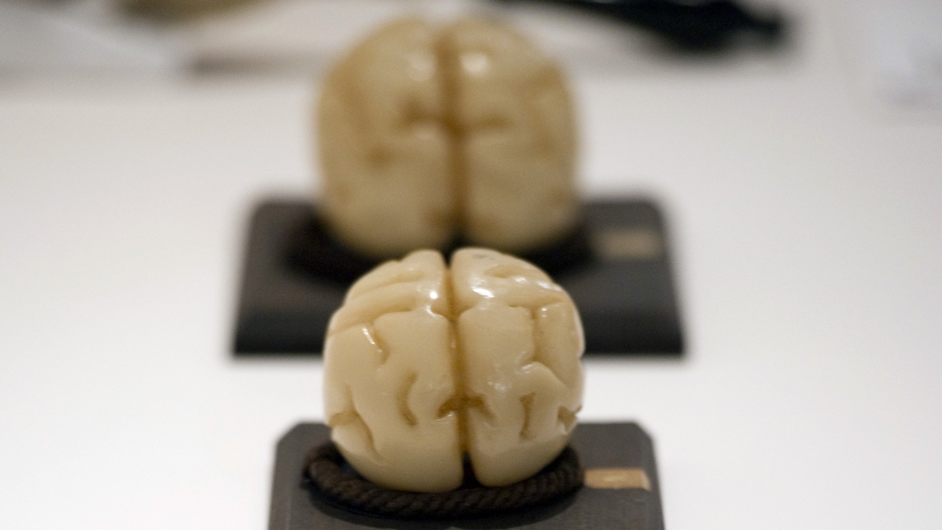 Ученые вырастили настоящий человеческий мозг. Настоящий человеческий мозг. Ученые вырастили настоящий человеческий мозг. Человеческий мозг в формалине. Искусственные органы человека.