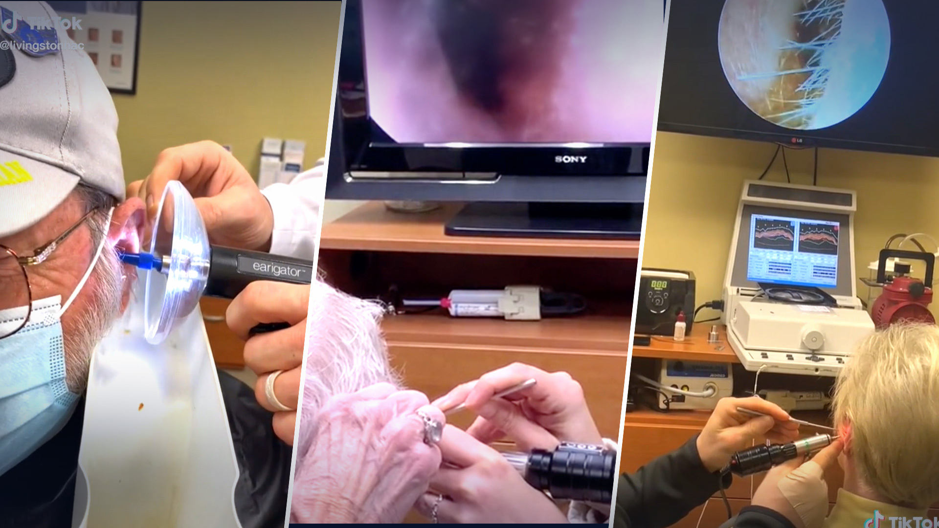 Livingston Hearing Aid Center se vuelve viral en TikTok sacando cera de