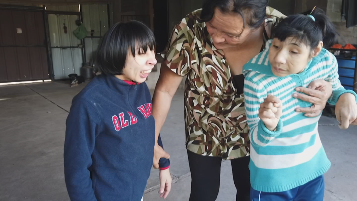 La historia de una mujer que lleva más de 40 años cuidando a sus dos hijas con microcefalia