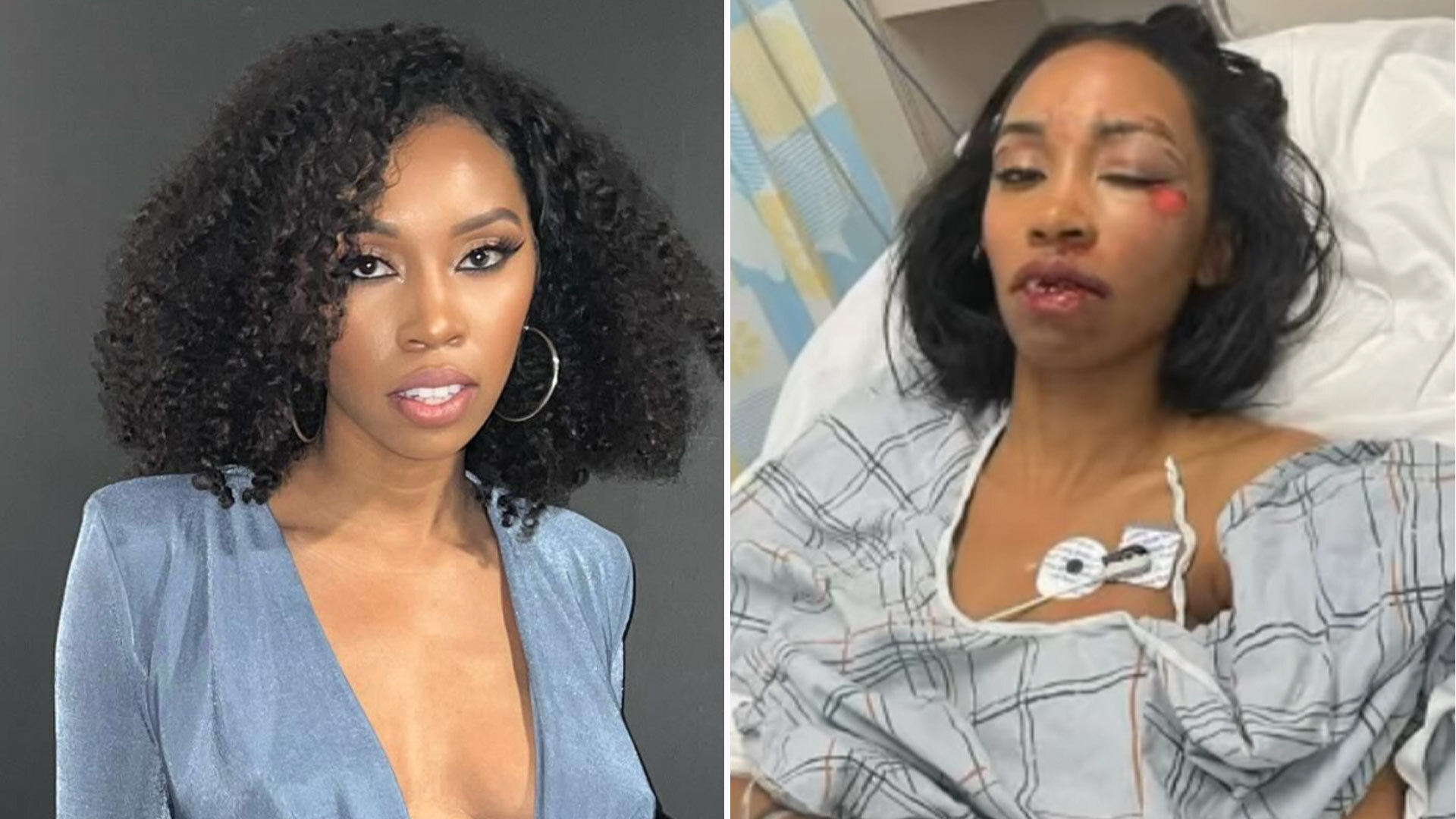 Marvel actress brutally beaten “can’t walk”: cries for help for her