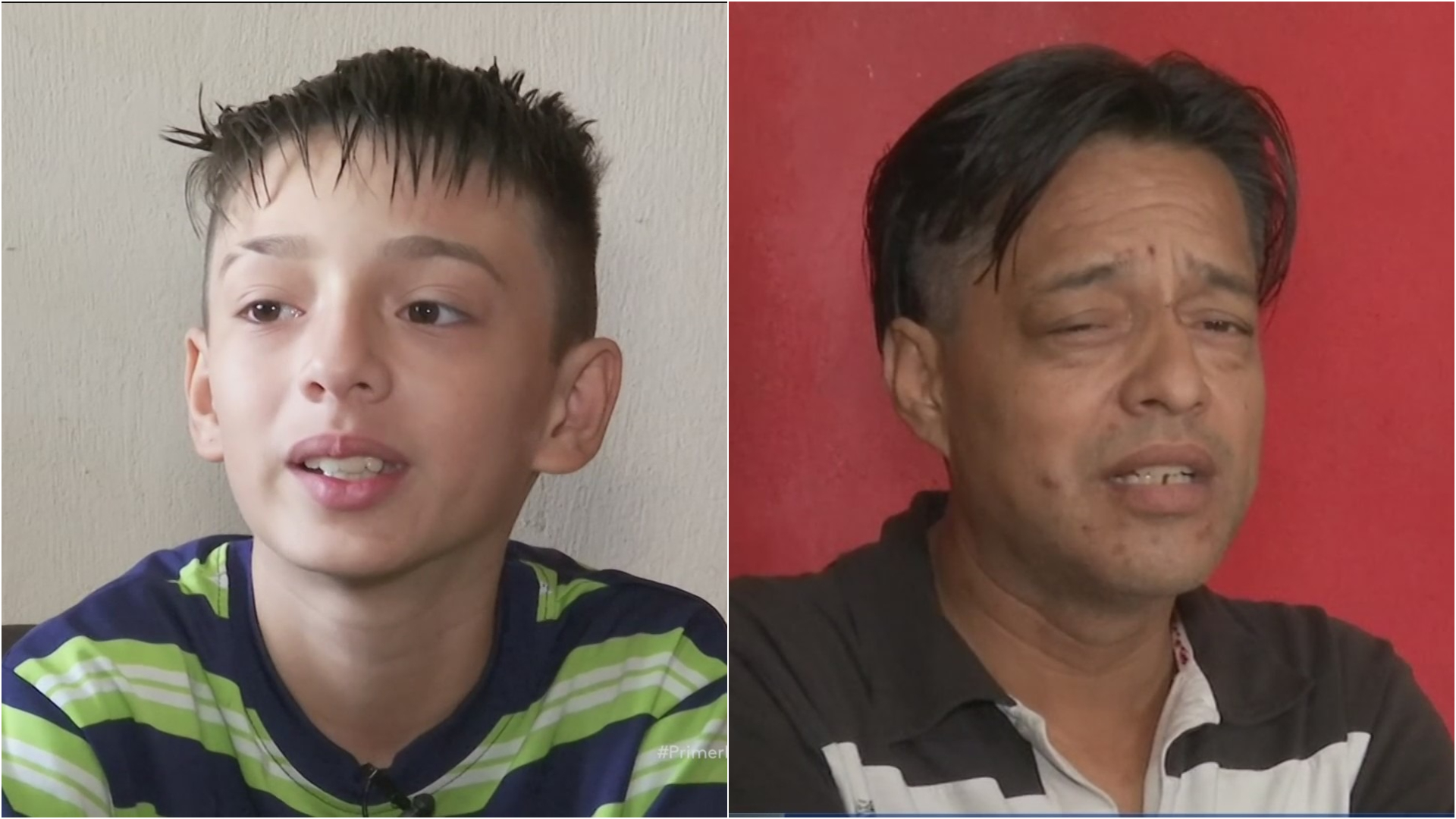 Ayuda de impacto Niño busca cómo pagar la cirugía que necesita su