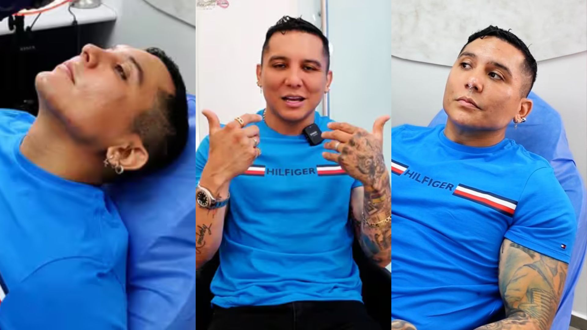 Edwin Luna luce casi irreconocible tras último retoque estético | Univision Famosos | Univision