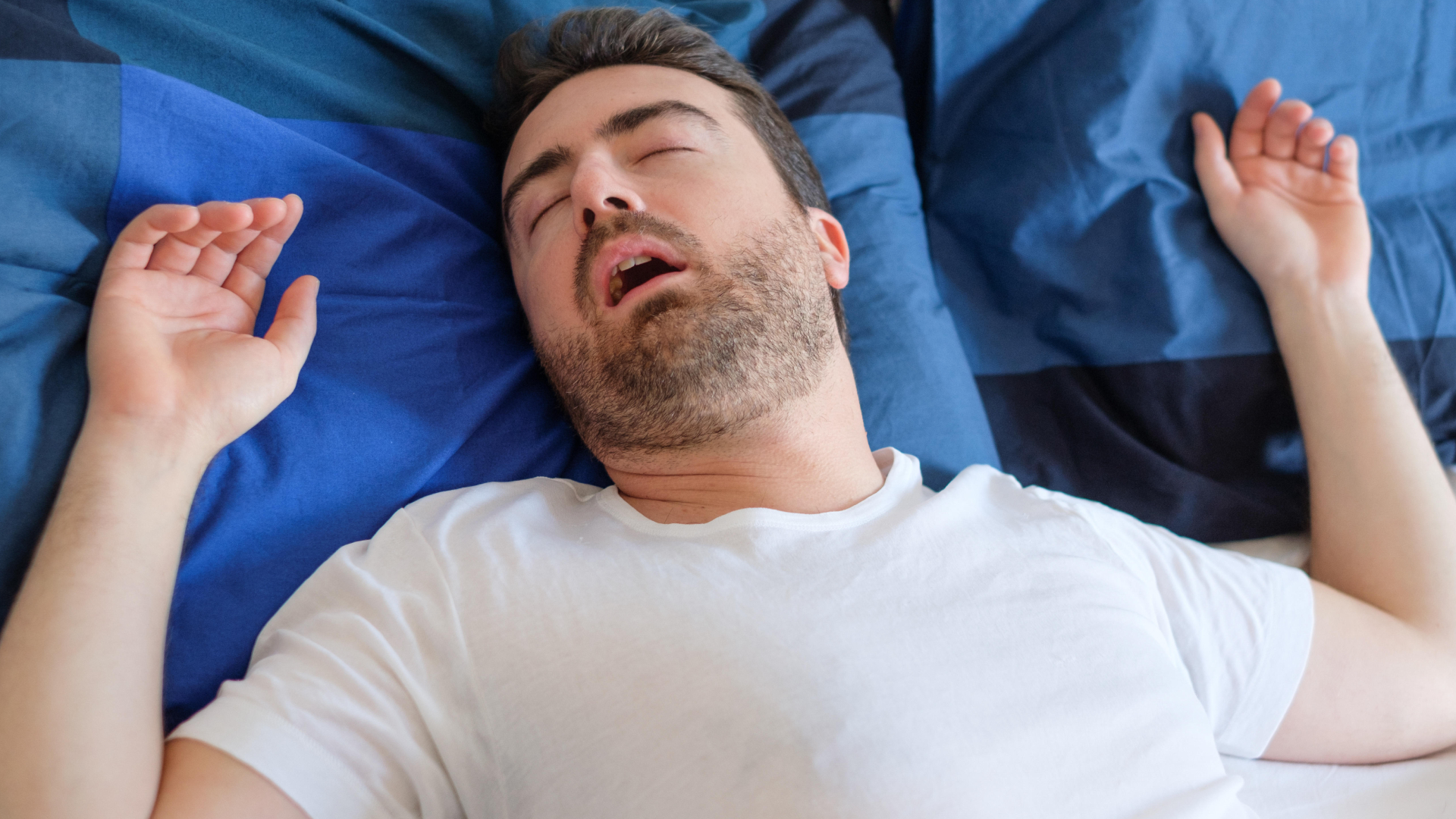 ¿Cuál es el tratamiento para la apnea de sueño? Dr. Juan nos dice cómo