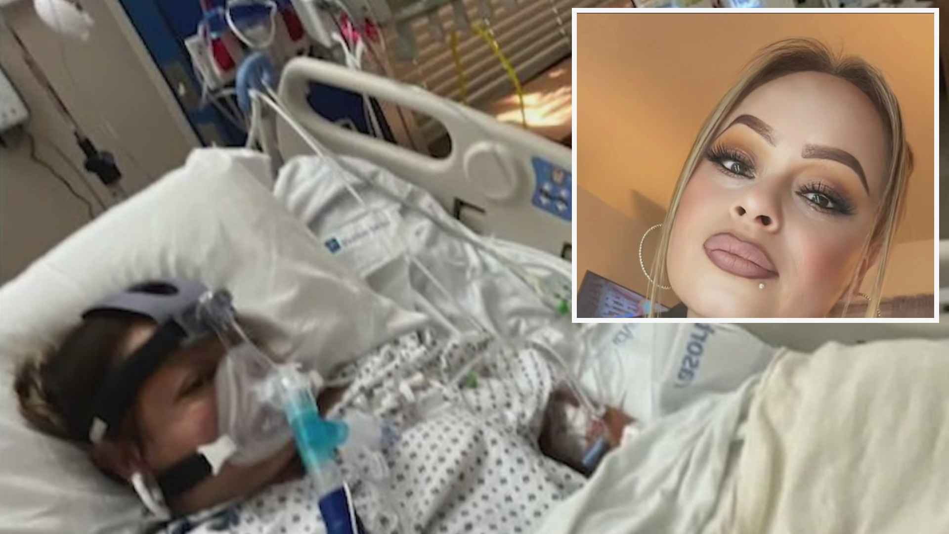 Mujer hispana pierde sus extremidades tras comer tilapia, una bacteria  podría ser la causal | Video | Univision 14 San Francisco KDTV | Univision