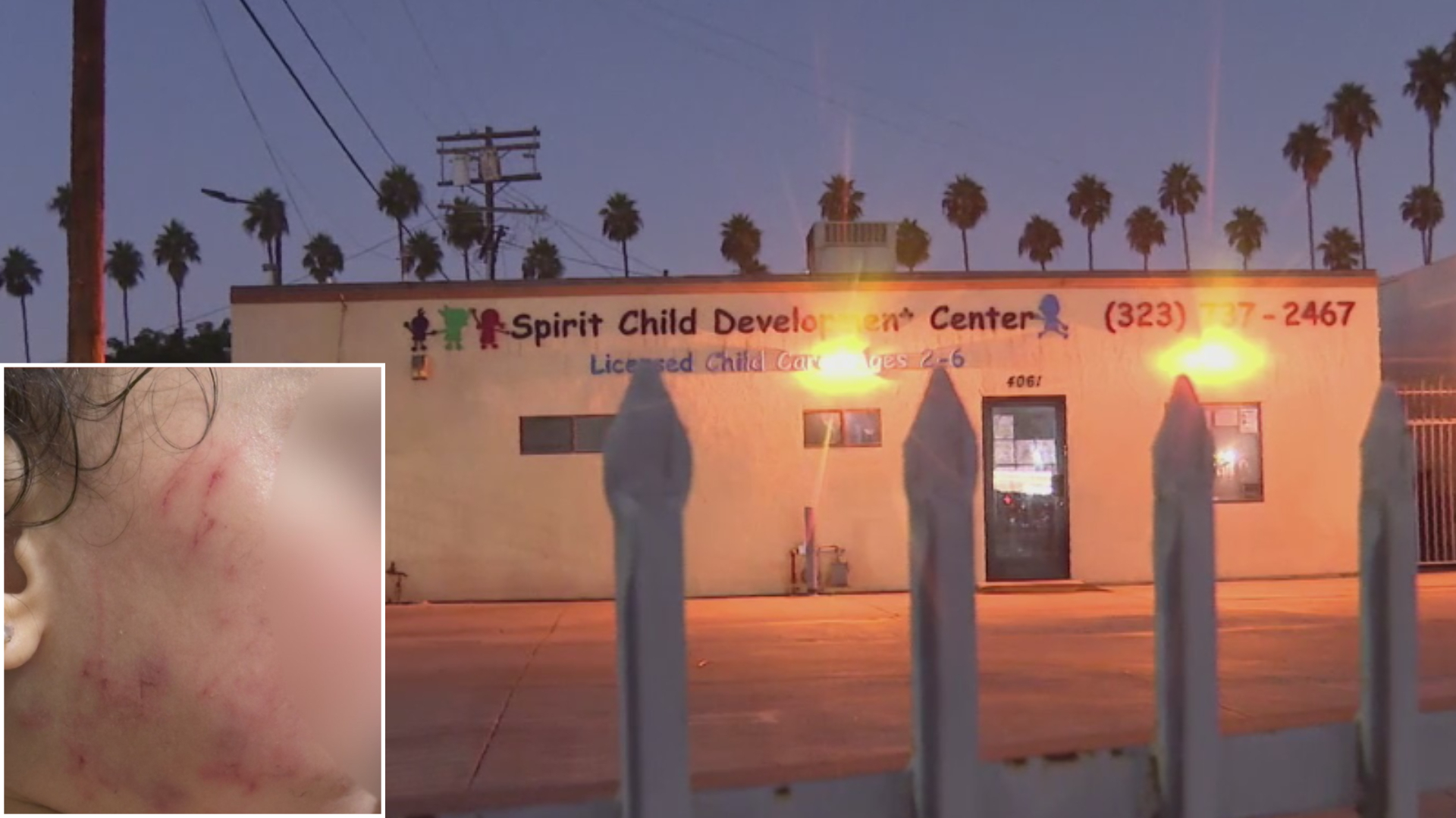 Madre denuncia agresión a su niña de 2 años en transporte escolar en Los Ángeles Video