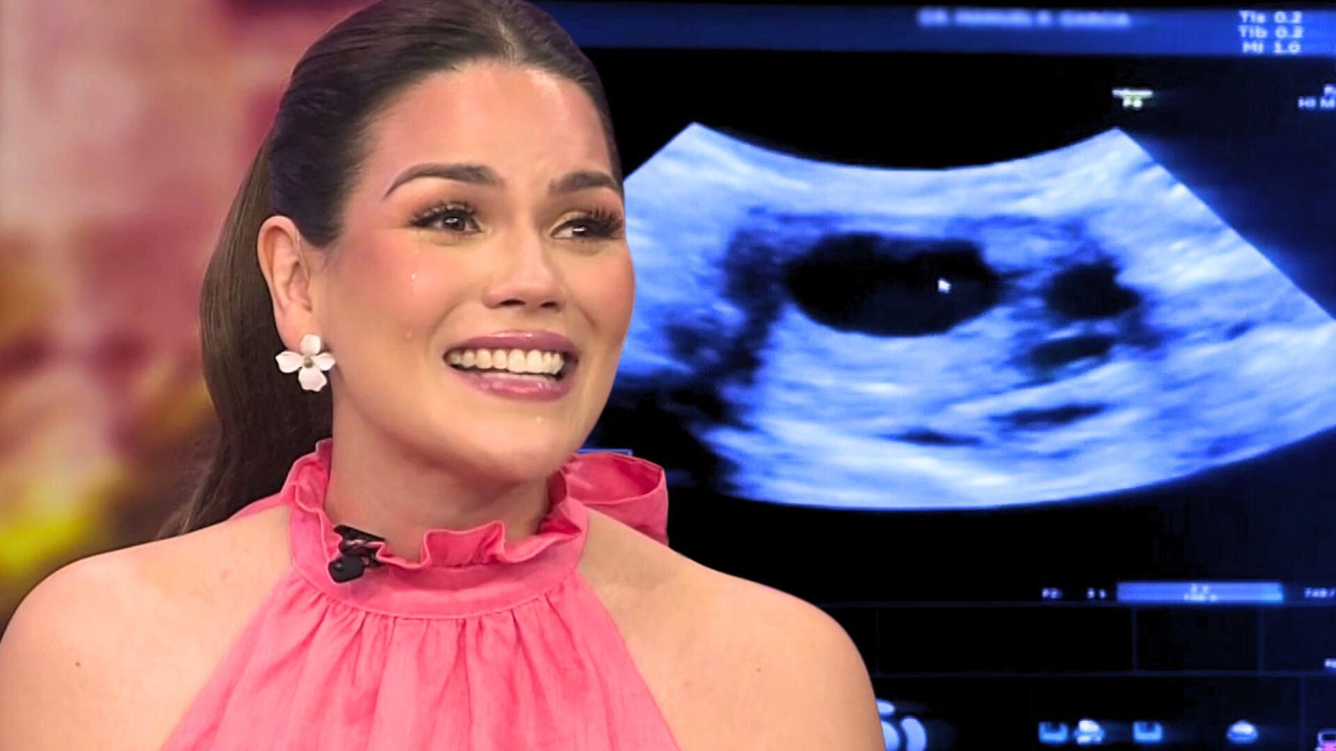 Karina Banda al borde del llanto habla de su procedimiento para congelar  sus óvulos