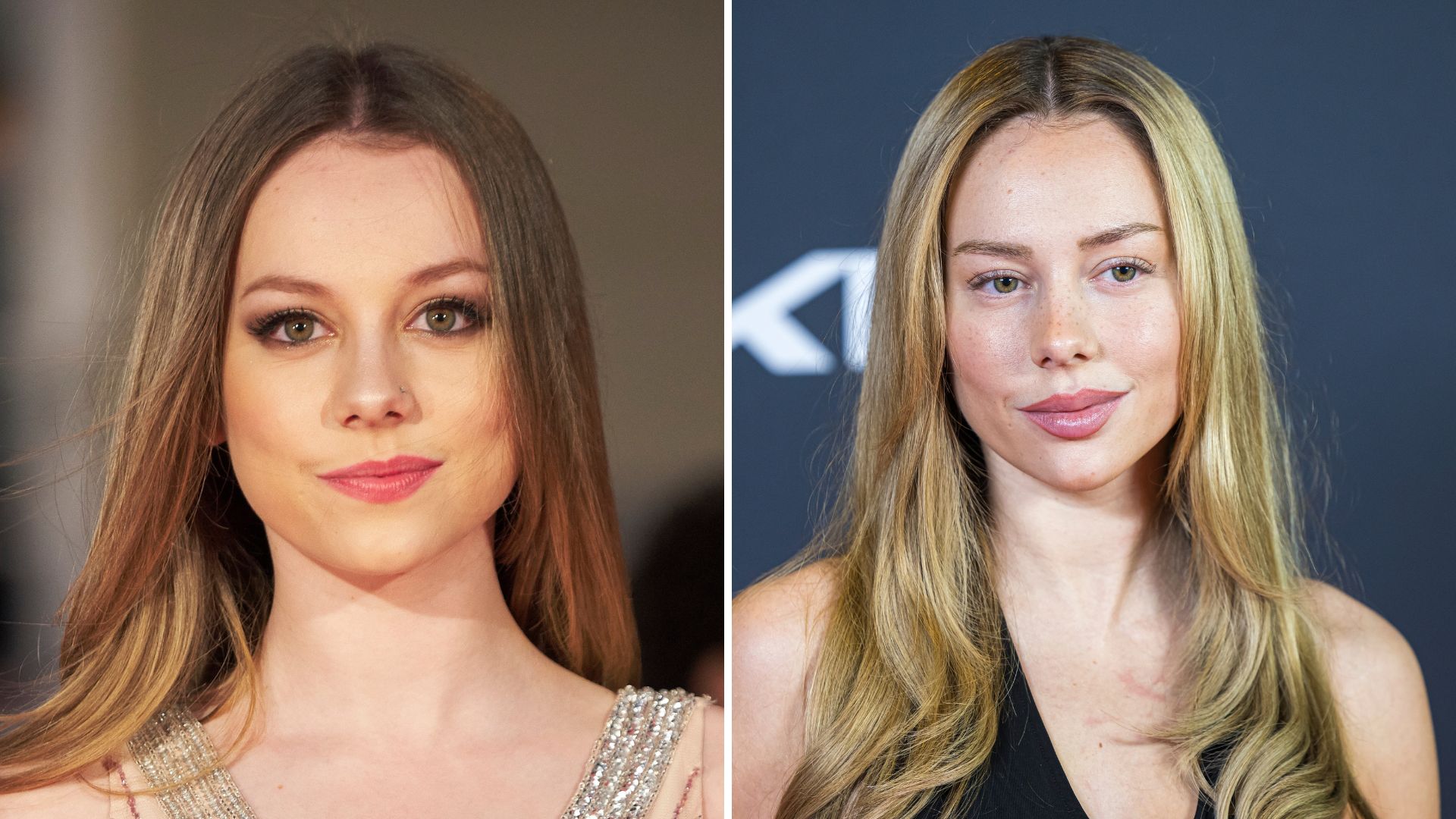 Ester Expósito antes y después de su transformación: las supuestas operaciones y cirugías que se hizo y lo que ha dicho sobre ellas | Univision Famosos | Univision