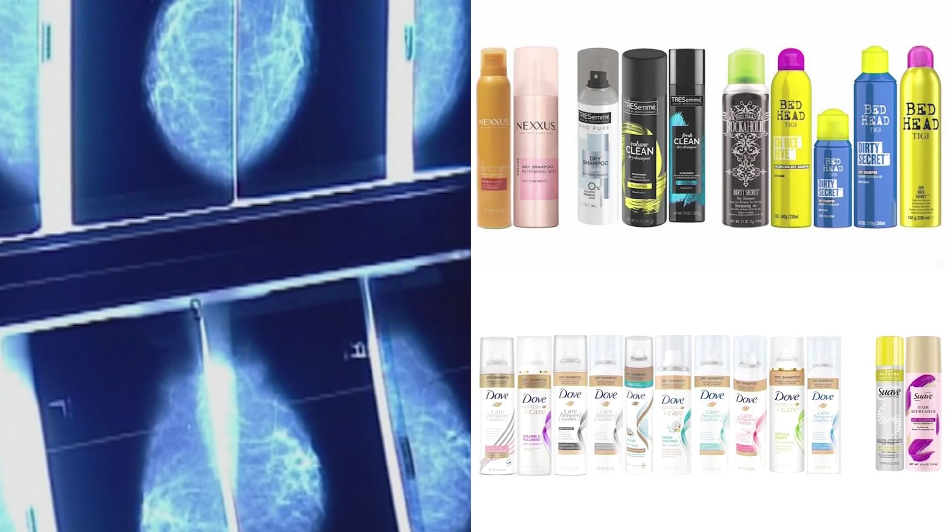 Retiran del mercado varias marcas de champú seco por contener altos