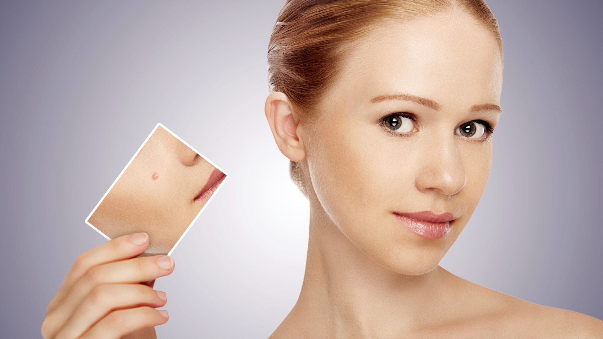 Alto consumo de Vitamina B12 puede provocarle acné Shows Despierta