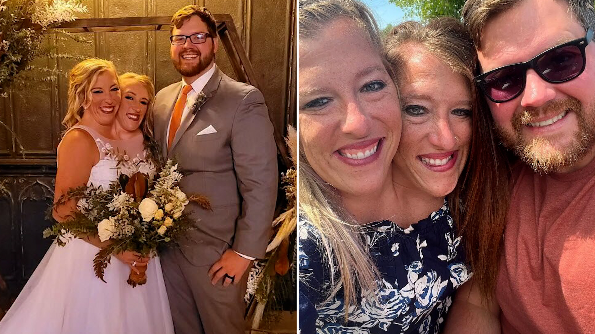 Siamesas Abby y Brittany Hensel: ¿Qué pasó con ellas? ¿Cuántos años tienen?  ¿Cómo viven? Su historia tras la boda de una de las gemelas |  Entretenimiento Cultura Pop | Univision, image size:1920x1080