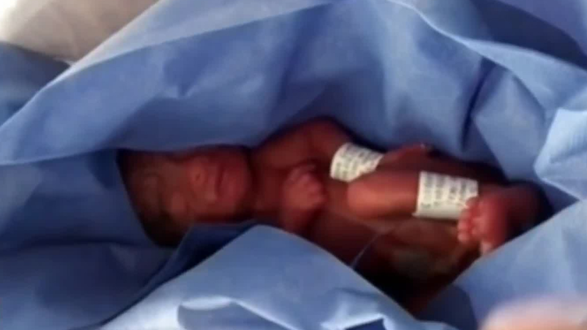 Medico Penso Que Un Bebe Prematuro Habia Nacido Sin Vida Pero Horas Despues Lo Escucharon Llorar Dentro De Una Refrigeradora En La Morgue Shows Primer Impacto Univision