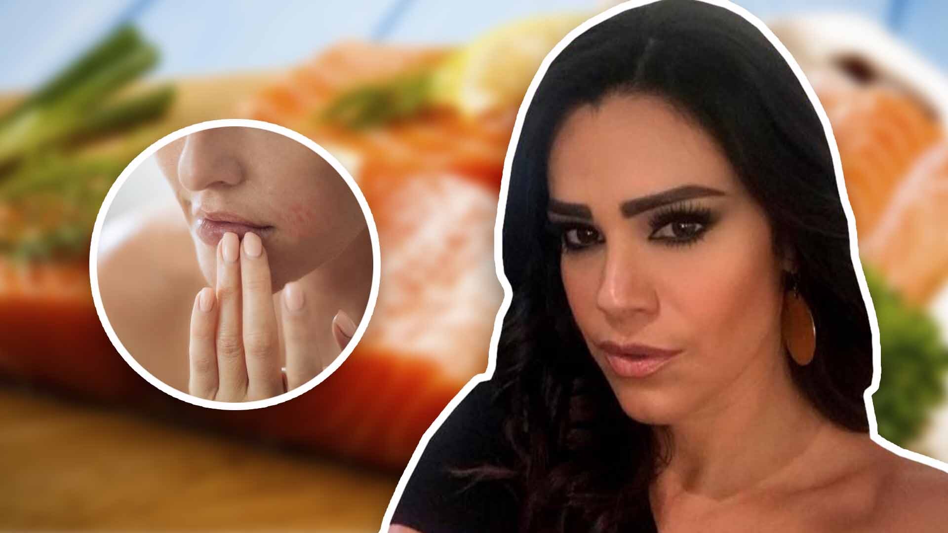 Me estaban tragando viva”: Luz Elena González encuentra larva dentro de su  rostro tras comer sushi | Estaciones de Radio El Free-Guey | Univision