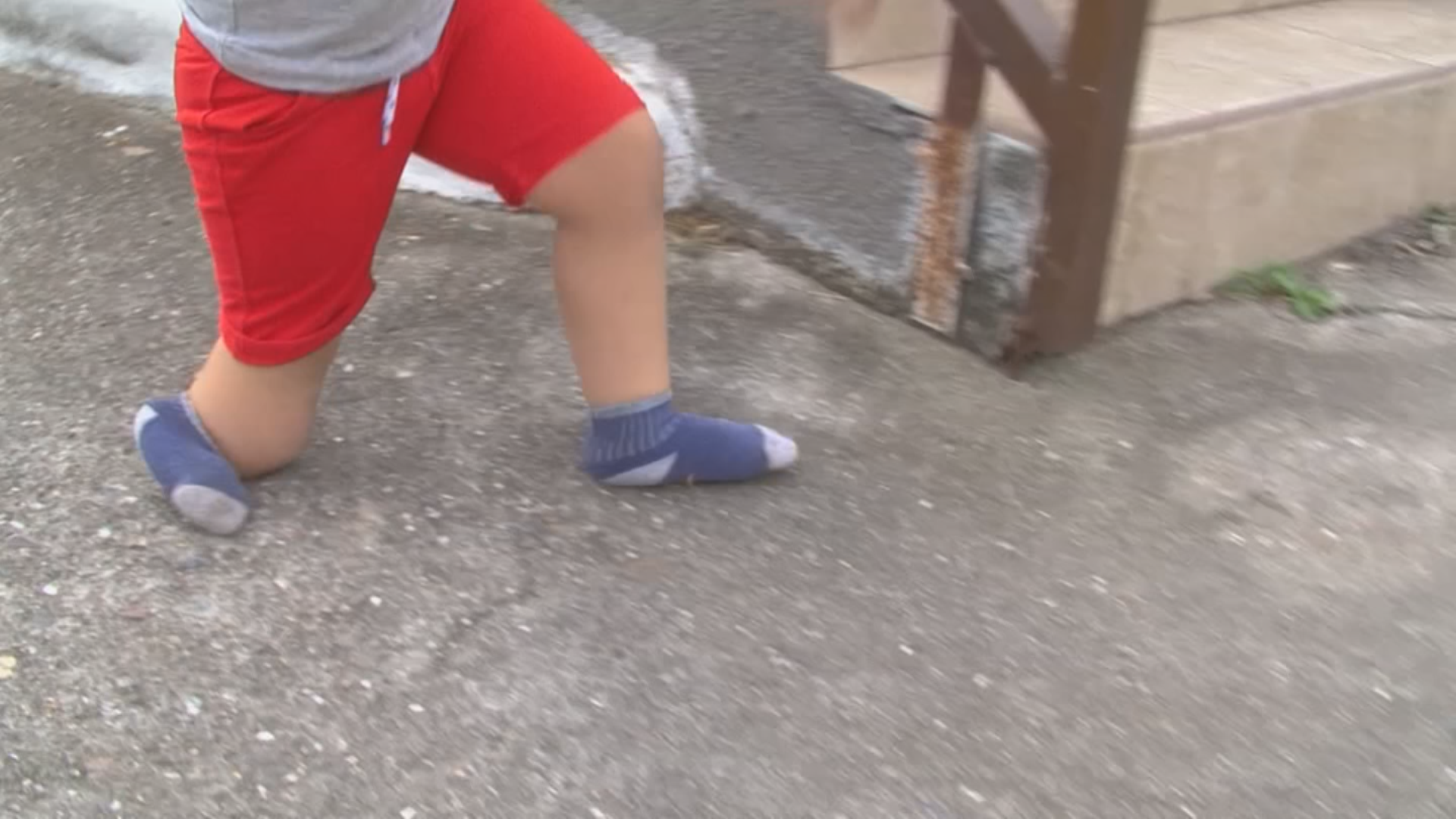 Ayuda de Impacto Este niño tiene una malformación en su pierna derecha en Honduras Shows