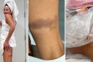 Así documentó Thalía su percance en el escenario.