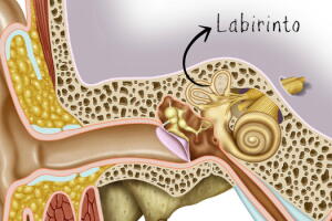 labirinto-labirintite.jpg