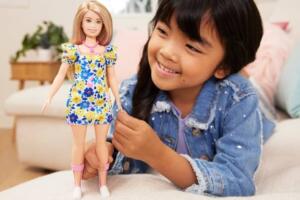 Barbie síndrome de Down