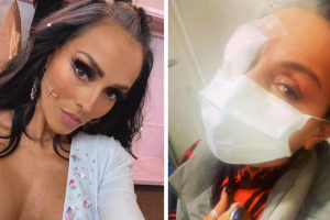 Ivonne Montero sufre accidente en un ojo: su córnea estaría afectada