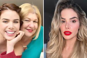 cirugias de marie claire harp antes y despues.jpg