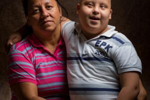 Niños con leucemia en Venezuela