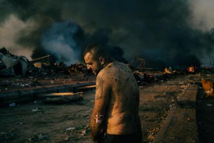 Fotografías ganadoras del World Press Photo 2021 | Al Dia Media BEIRUT, LEBANON - AUGUST 4: An injured man stands inside the wrecked site of the port of Beirut while firefighters work to put out the fires that engulfed the warehouses after the explosion. (Photo by Lorenzo Tugnoli/ Contrasto for The Washington Post)