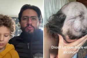 Padre de familia se queda profundamente dormido y sus hijos lo raparon (antes y después)