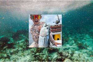 La niña fue operada durante seis horas y los médicos lograron reimplantar su mano, que ahora puede mover parcialmente.