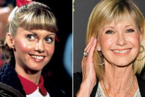 olivia-newton-john-antes-depois-0822-1400x800