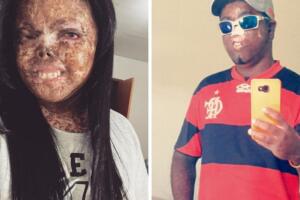 hermanos con cáncer.jpg