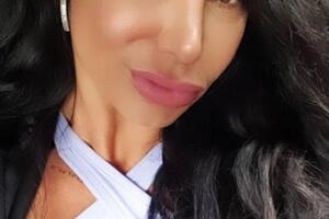 lis vega labios2.jpg
