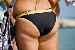 bumbum-celulite-praia.jpg
