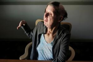 charla Nash sobreviviente al ataque del chimpancé travis.jpg