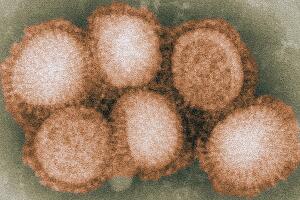 1200px-H1N1_navbox.jpg
