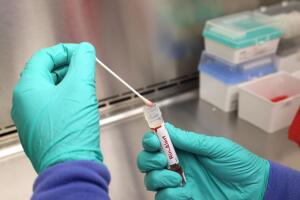 UW Medicine Virology Lab Tests For Monkeypox Virus