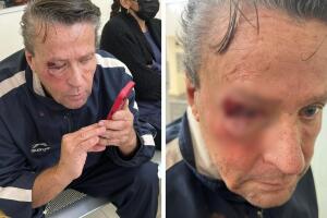 Alfredo Adame golpeado en un incidente policíaco