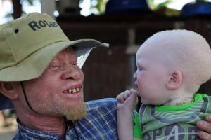 albinos-africa-4.jpg