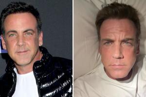 Carlos Ponce responde a quien le dice que “le pusieron mal el botox” en el rostro: hay una razón médica