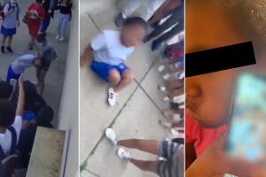 Niña de Nueva Jersey es víctima de bullying por ser ‘pequeñita’ y no poder escuchar bien