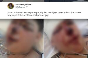 Estas fueron las fotos que compartió Sebastián Adame y que causaron preocupación entre sus seguidores.  