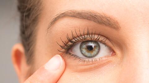 Tienes Puntitos Blancos Debajo De Los Ojos Eliminalos Con Estos Remedios Naturales Estilo De Vida Belleza Univision Tienes Puntitos Blancos Debajo De Los Ojos Eliminalos Con Estos Remedios Naturales Estilo De Vida Belleza Univision