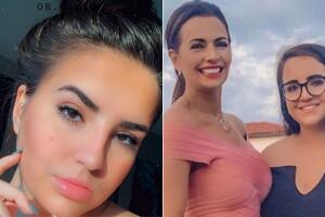 Hija de Cecilia Galliano habla del fuerte accidente que le dejó quemaduras: “Me quedaron marcas”