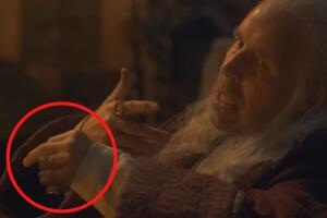 House of the Dragon heridas del rey Viserys herida y dedos.jpg