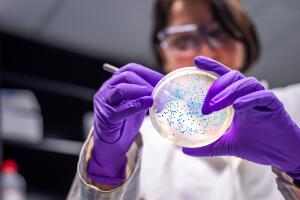 Cientista observando placa com cultura de bactérias