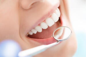 6 mentiras sobre dentes do siso que você sempre acreditou serem verdade 