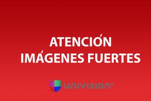 Atención Imágenes Fuertes