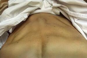 barriga-gravida-sarada-apos-dar-luz-3.jpg