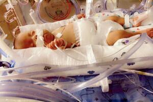 Bebé hispano sale del hospital tras varios meses internado.