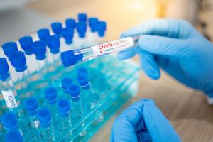Medical scientist hand with blue sterile rubber gloves holding COVID-19 test tube in hospital laboratory. Male doctor or physician getting result of Coronavirus case. 2019-nCoV lab test concept