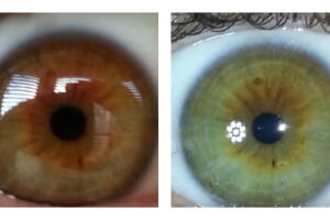 olhos-crugiveros-2.jpg
