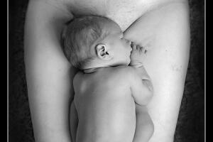 foto-bebe-cicatriz-cesarea.jpg