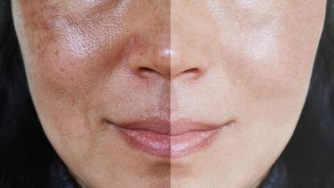 9. Ingredientes necesarios para realizar la receta de blanqueamiento de piel con bicarbonato